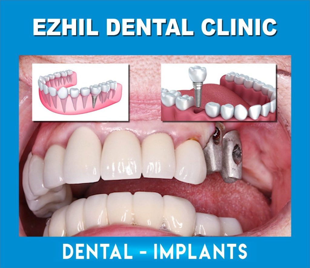 ezhilmultispecialitydentalclinic